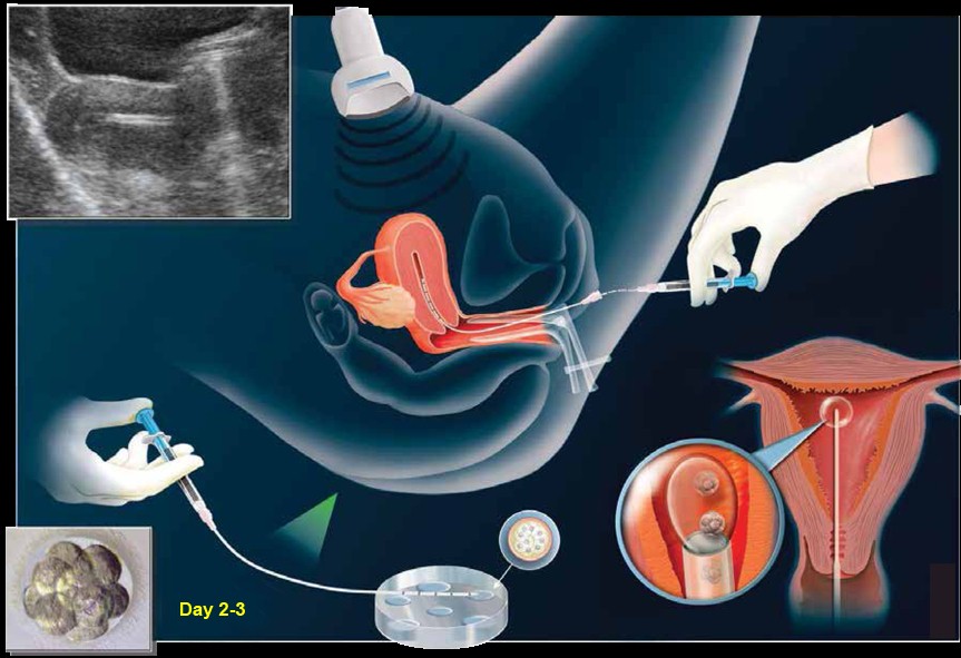 images/embriologi/imbasan semasa mengandung.jpg